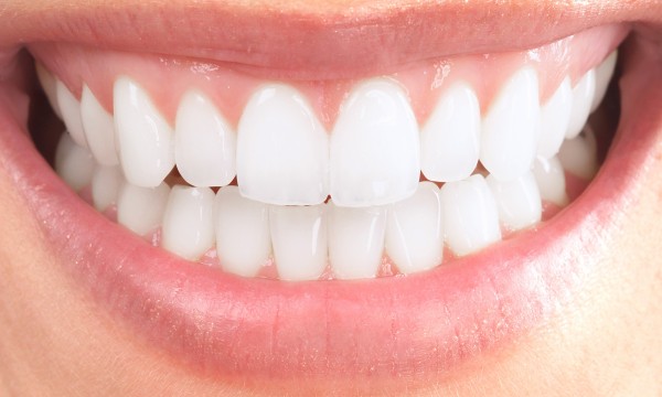 Tooth veneers can help you get your bright smile back