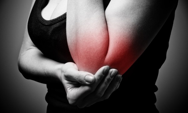 Osteoarthritis: 3 known contributors and some history