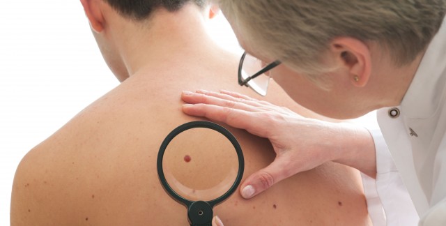 7 stratégies pour repousser le cancer de la peau